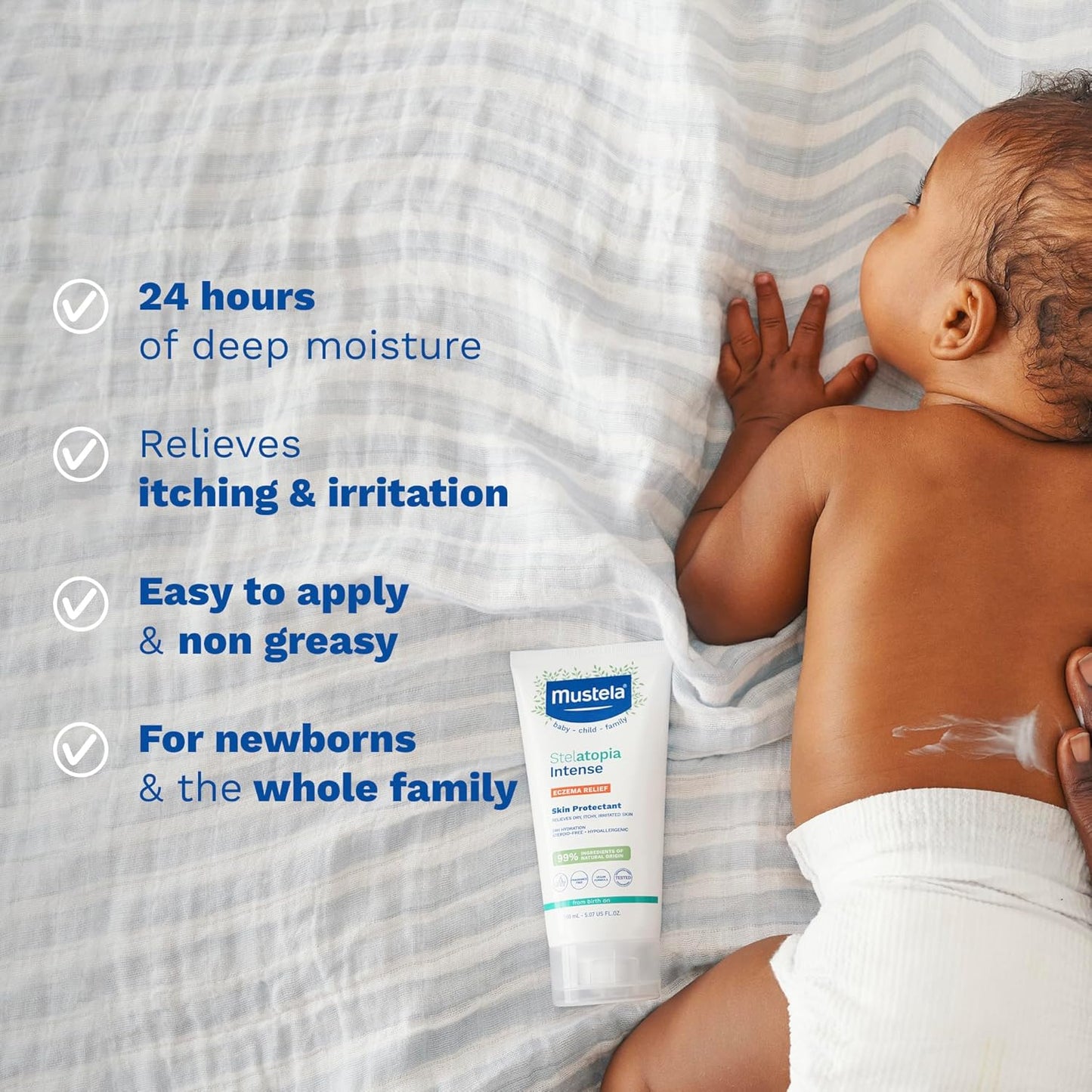 Mustela Eczema Relief Cream Stelatopia Intense, 5.07 fl oz, Frag-Free, Exp 7/27