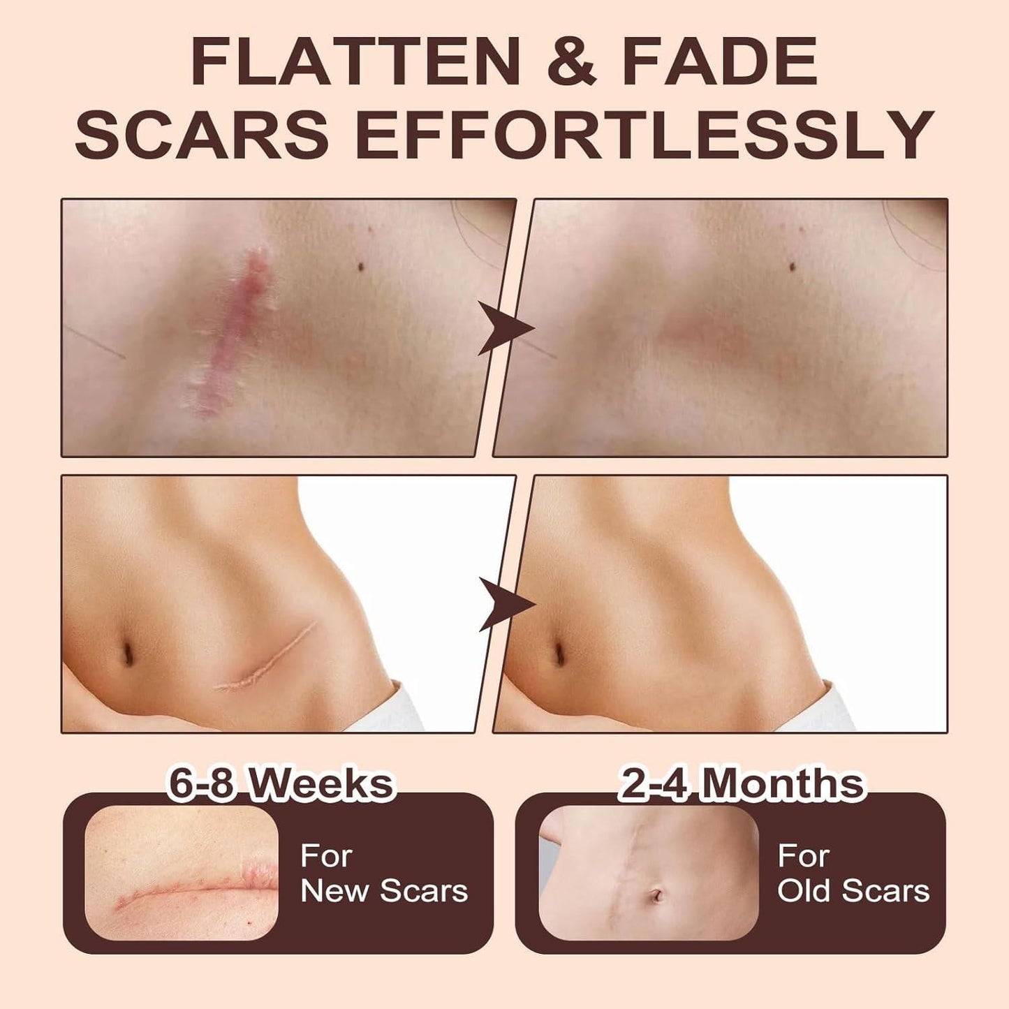 Scar Solutions Silicone Scar Stick,60% Silicone - Face & Body, (2 Pk) -Exp. 7/28