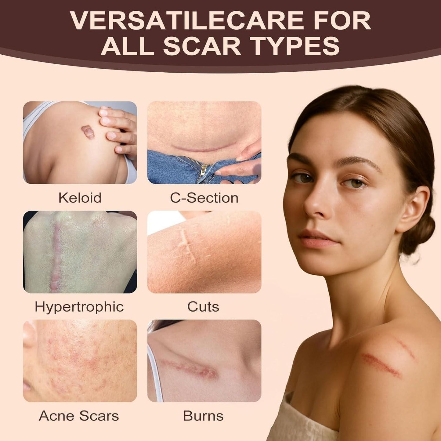 Scar Solutions Silicone Scar Stick,60% Silicone - Face & Body, (2 Pk) -Exp. 7/28