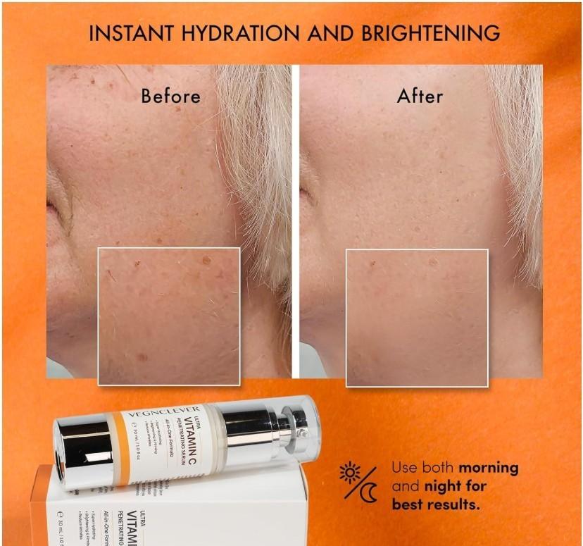 Vegnclever Super Vitamin C Serum, Anti-Aging Formula, 1 oz Exp. 11/26, Free Ship