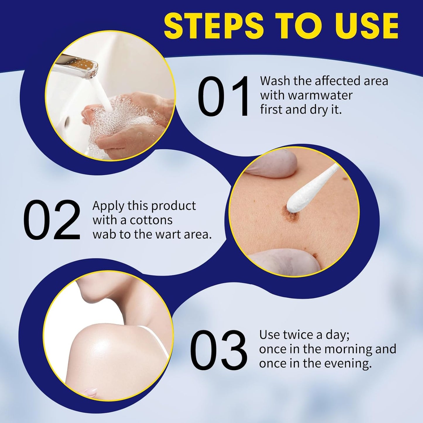 Bighero Liquid Wart, Corn, & Callus Remover (2 Pack, 2 oz total) Exp. 11/26