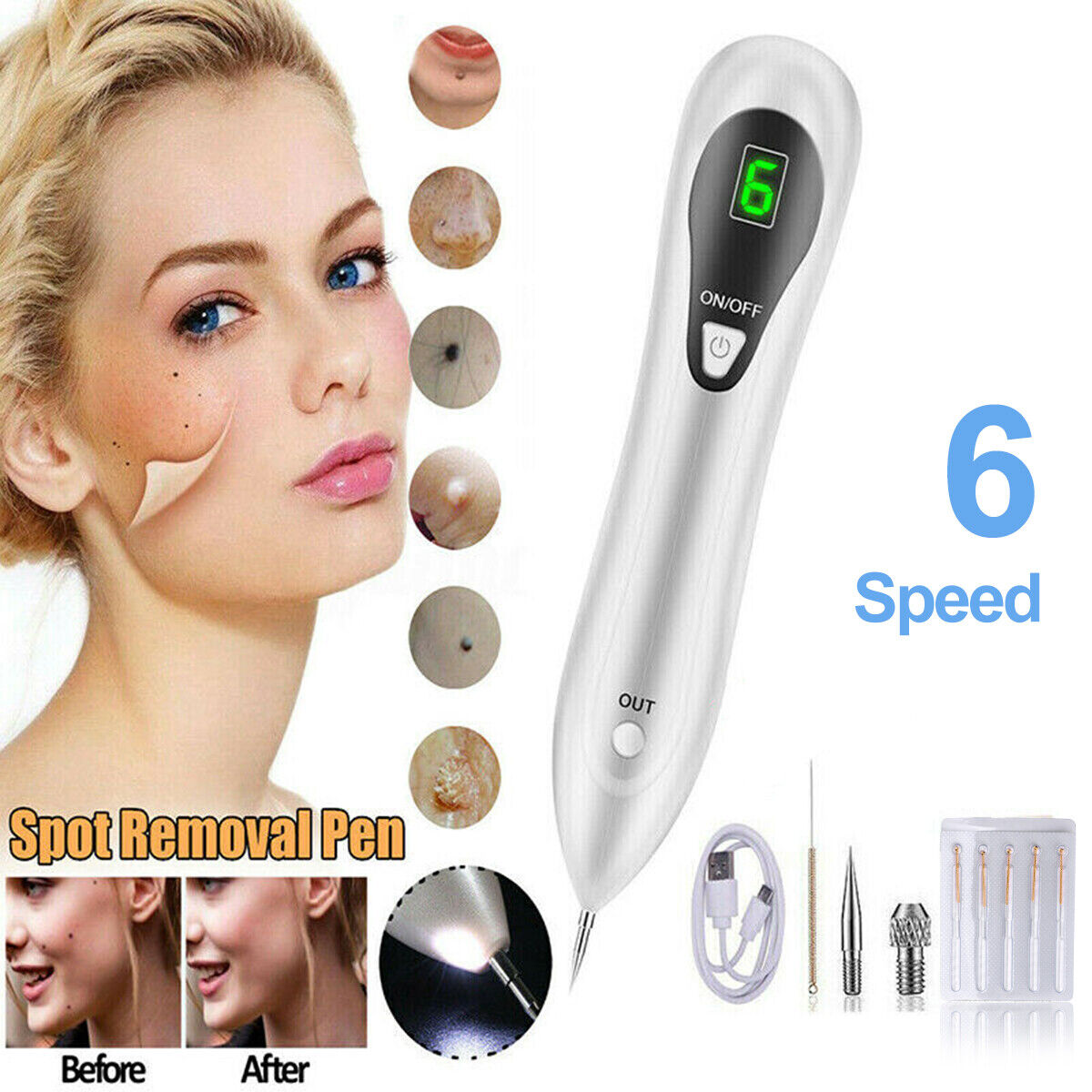Anti Aging Laser Plasma Pen, 6 Speed Nevus- Mole, Spot, Wart, Tag, Tatoo Removal - New!