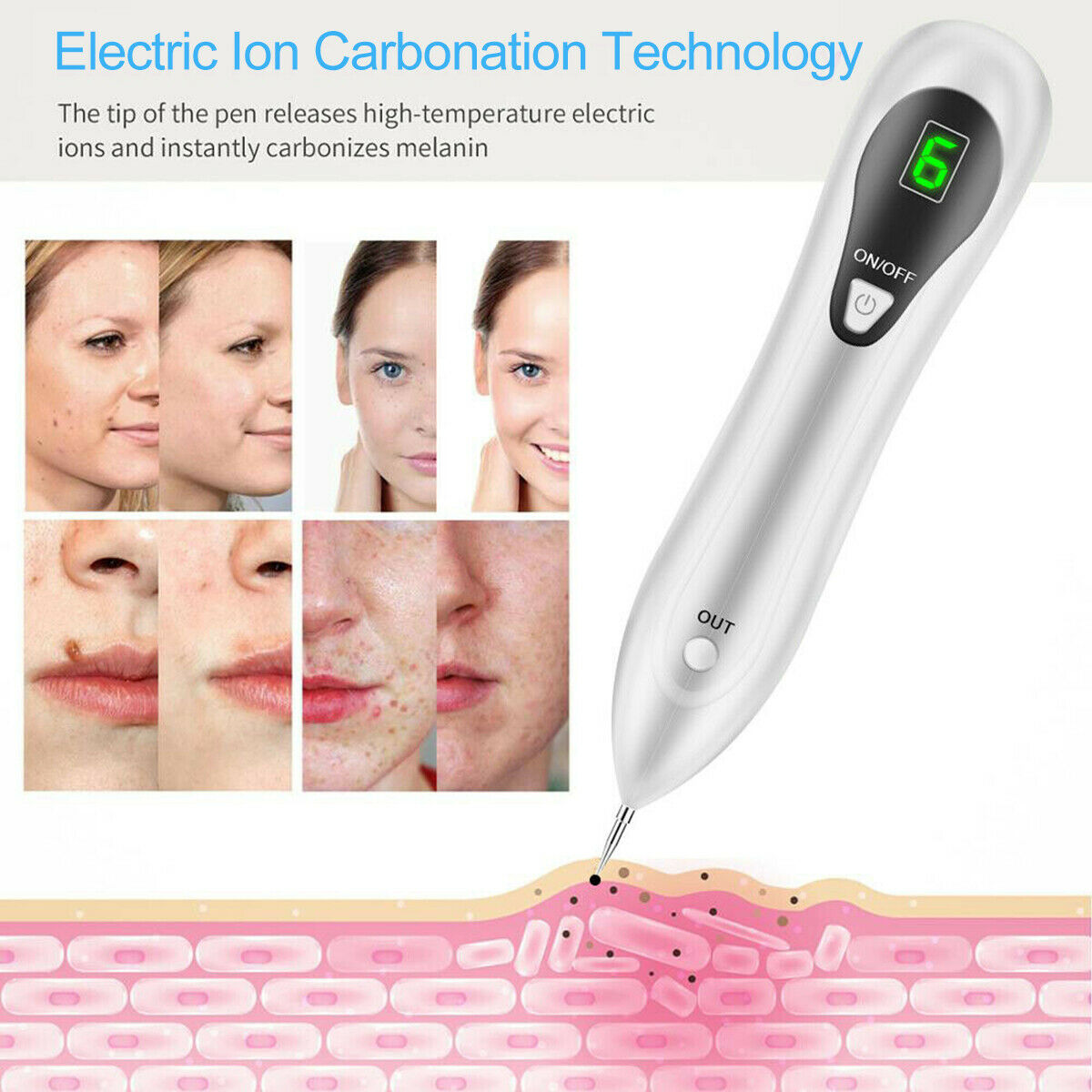 Anti Aging Laser Plasma Pen, 6 Speed Nevus- Mole, Spot, Wart, Tag, Tatoo Removal - New!