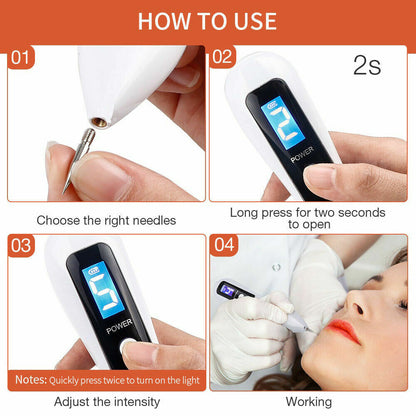 Anti Aging Laser Plasma Pen, 6 Speed - Mole, Spot, Wart, Tag, Tatoo Removal