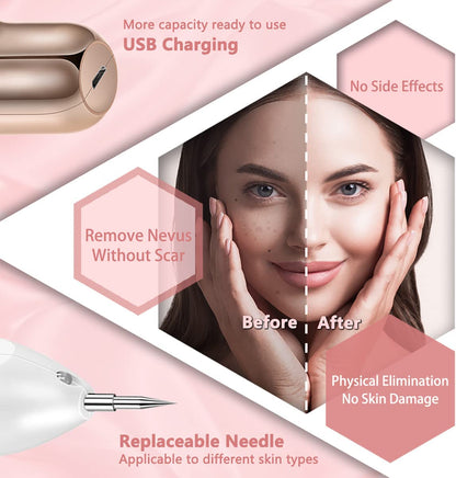 Anti Aging Laser Plasma Pen, 9 Speed - Mole, Spot, Wart, Tag, Tatoo Removal - New!