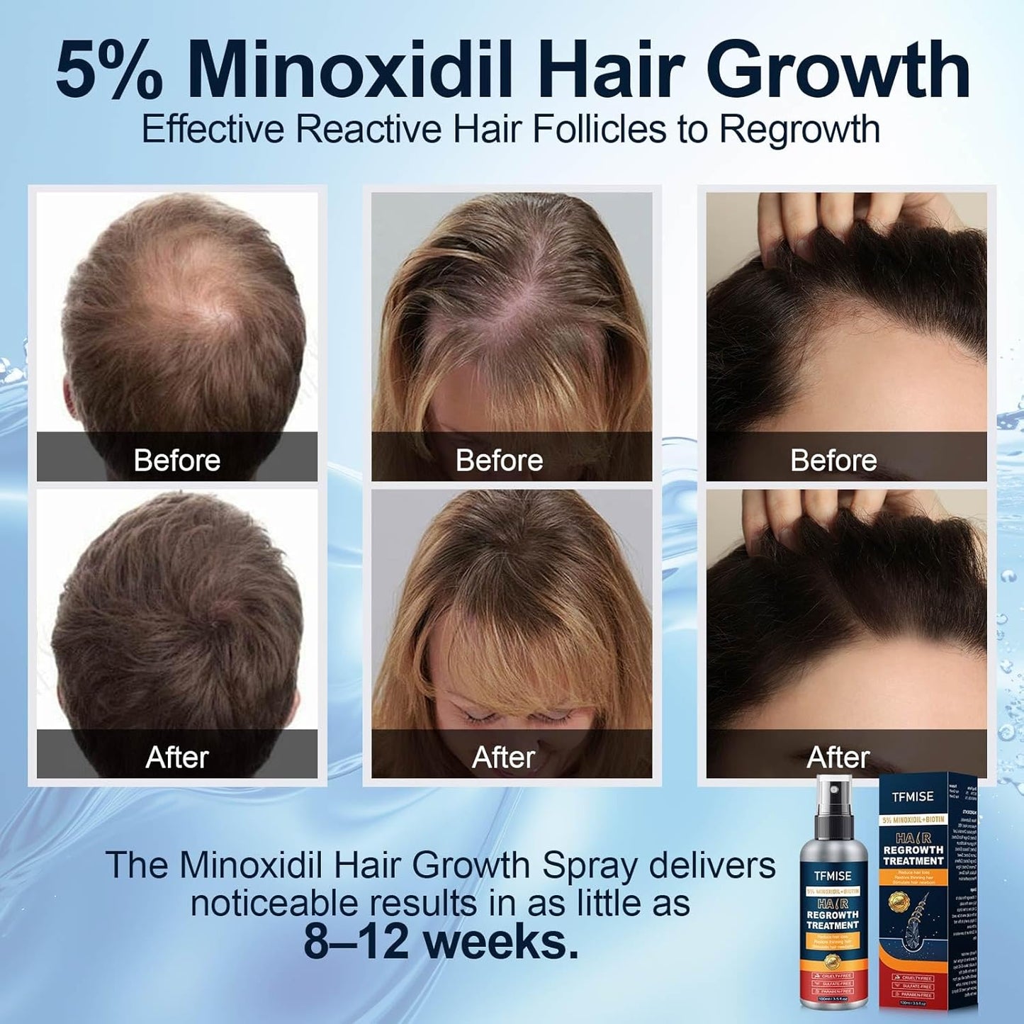 TFMISE 5% Minoxidil + Biotin Hair Regrowth Treatment, 3.5 oz, Exp. 9/27