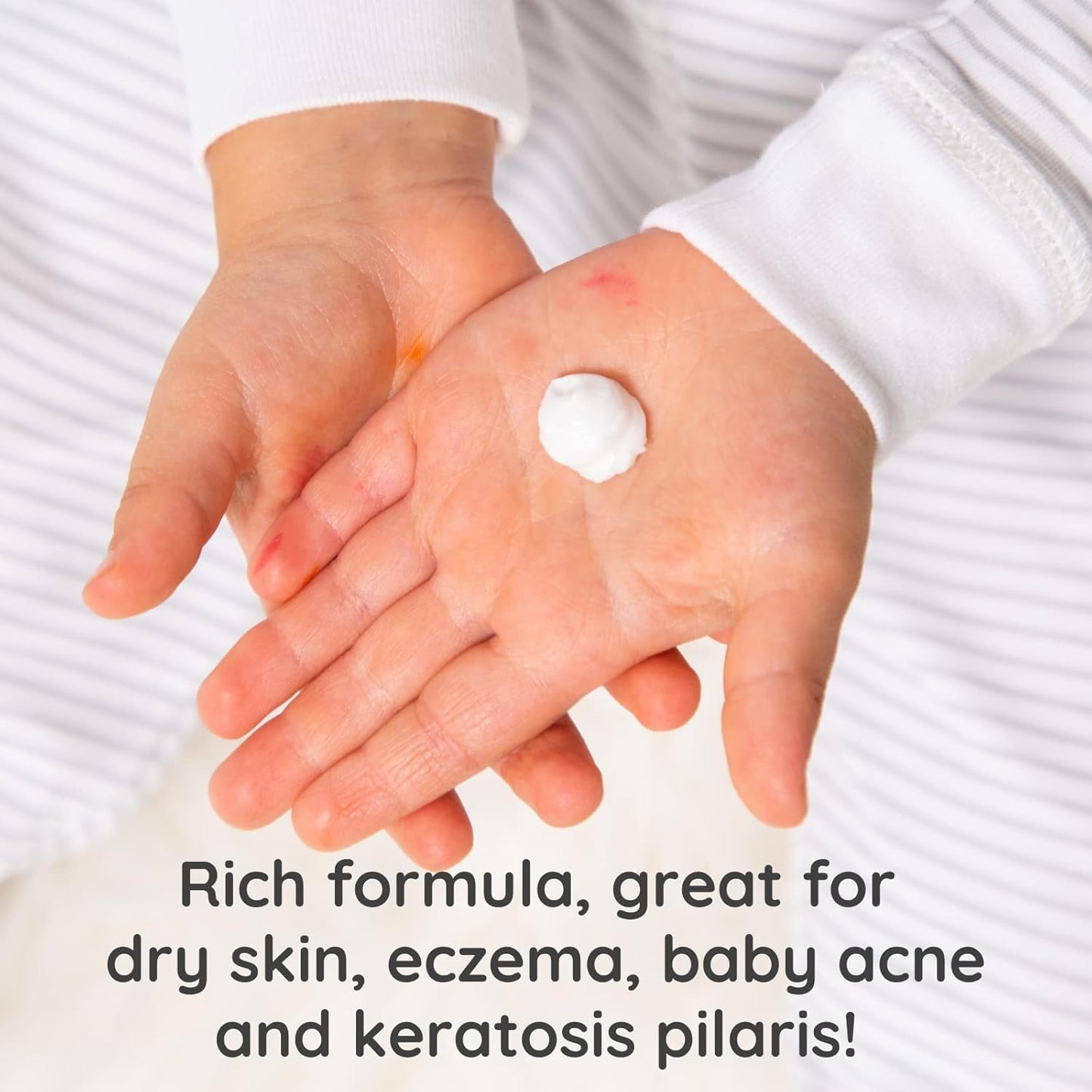 Bubbsi Whipped Coconut Oil Body Cream & Baby Eczema Lotion, 8 oz Bottle, New!