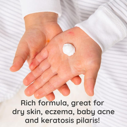 Bubbsi Whipped Coconut Oil Body Cream & Baby Eczema Lotion, 8 oz Bottle, New!