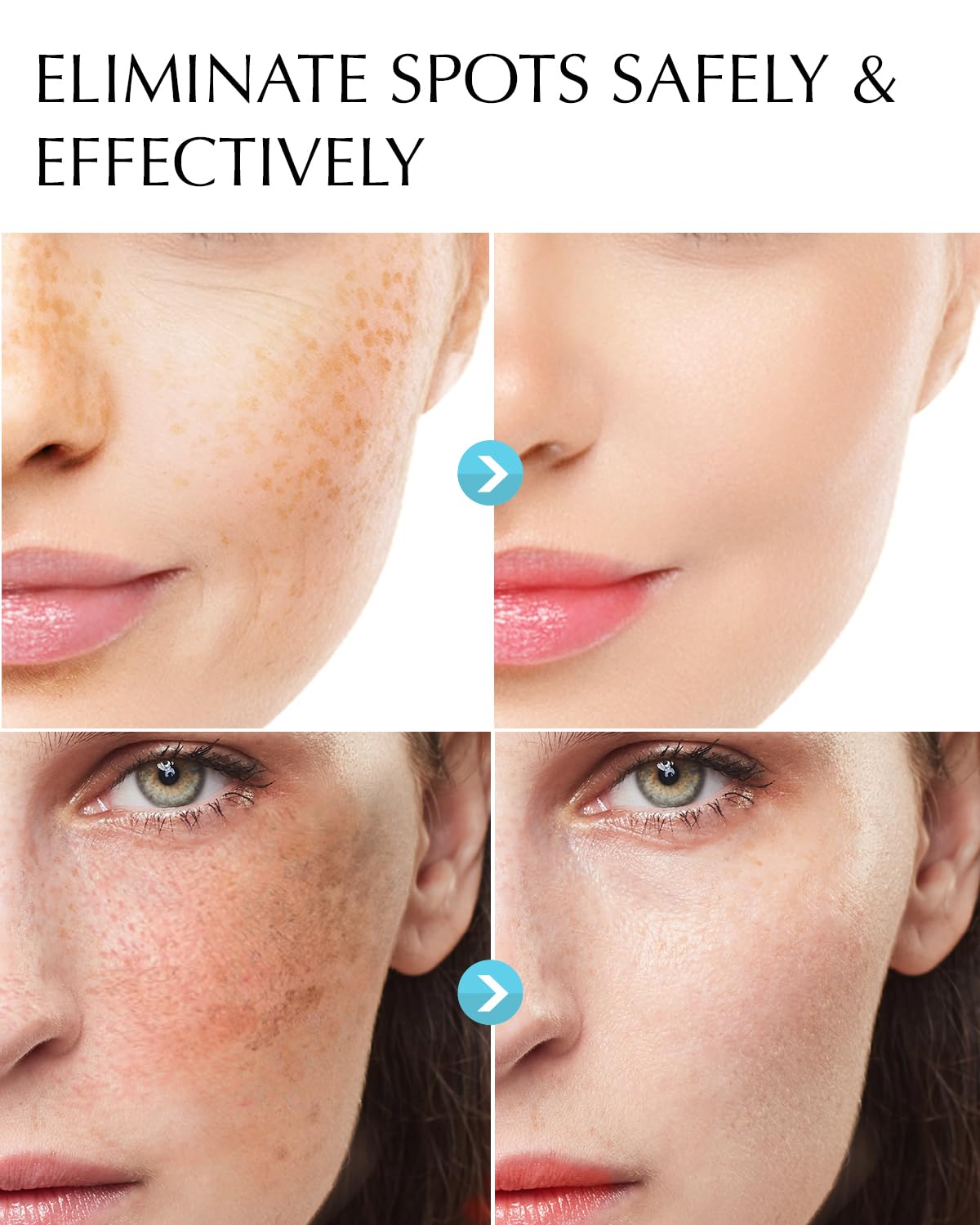 Enaskin Dark Spot Corrector Cream, Complexion Brighter, 1.7 oz, New (Sealed)!