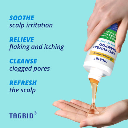 TAGRID Anti-Fungal Shampoo, Scalp Treatment - Relieves Itching, 10 oz, Exp. 6/27